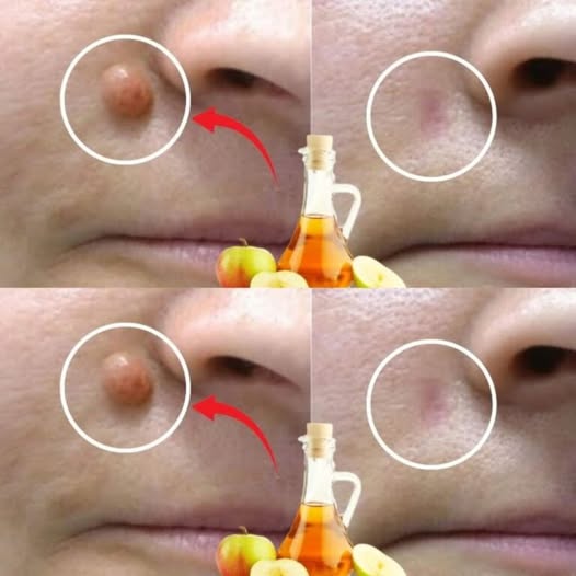 475845756 122173041992279931 2822836050270931499 N