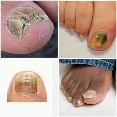 472559850 606161839035789 4574492648634272102 N