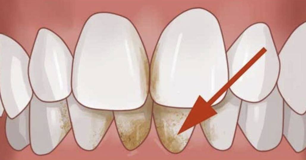 473281105 614959638156009 8561603319825421878 N