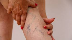 486466957 122184290546279931 2662029238877847690 N