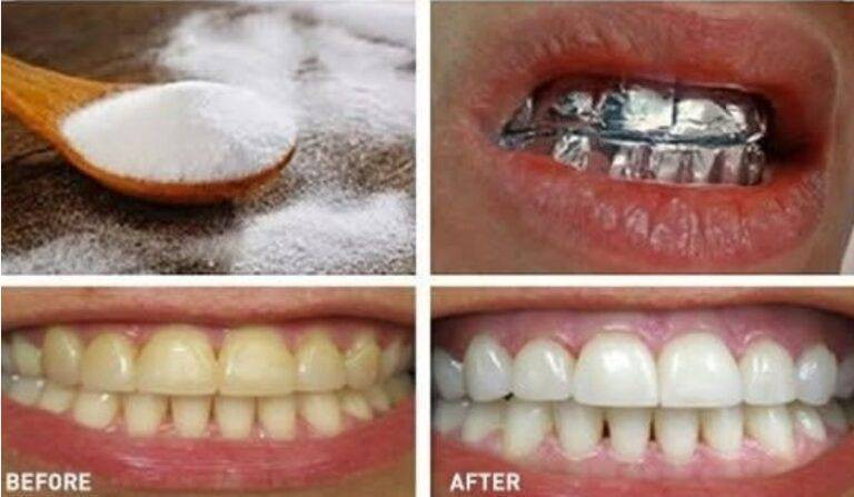 508406372 122200042826279931 2723004709635841268 N