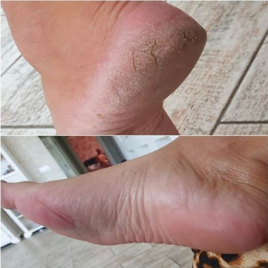 515078152 122210916872279931 2859781877669669598 N