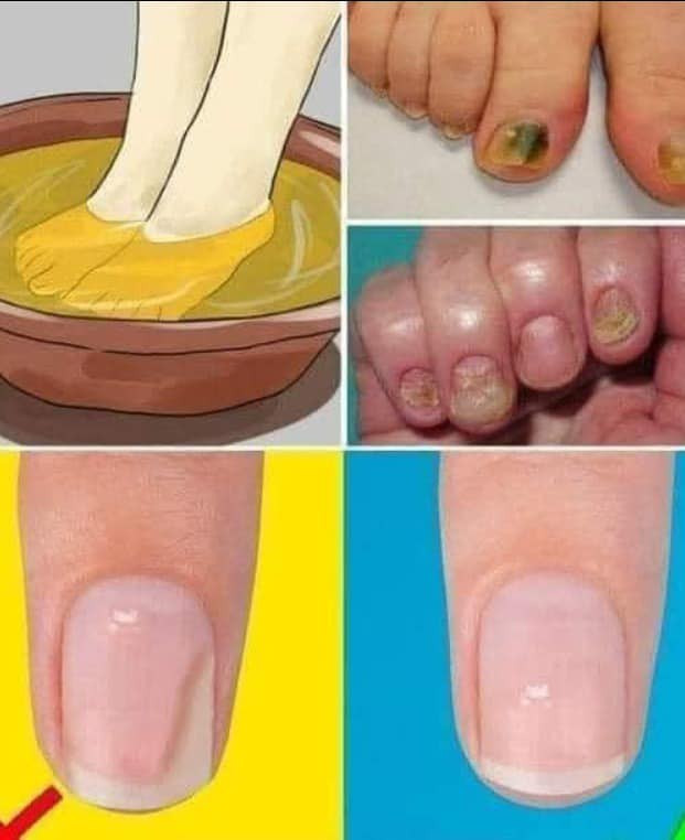 515978807 122211628190279931 2794606841465856677 N