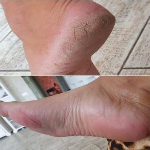 536281187 122211220532279931 3197684812148831810 N (1)