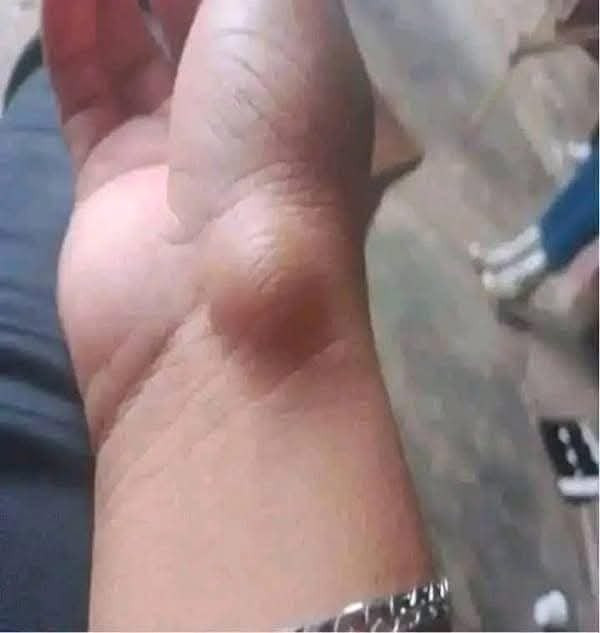 537143678 122211535886279931 1564042816764591898 N