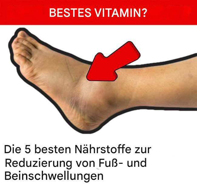 539590824 122212366424279931 3112852598270045601 N